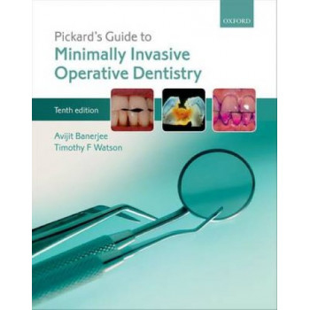 Pickard's Guide to Minimally Invasive Operative Dentistry 10E